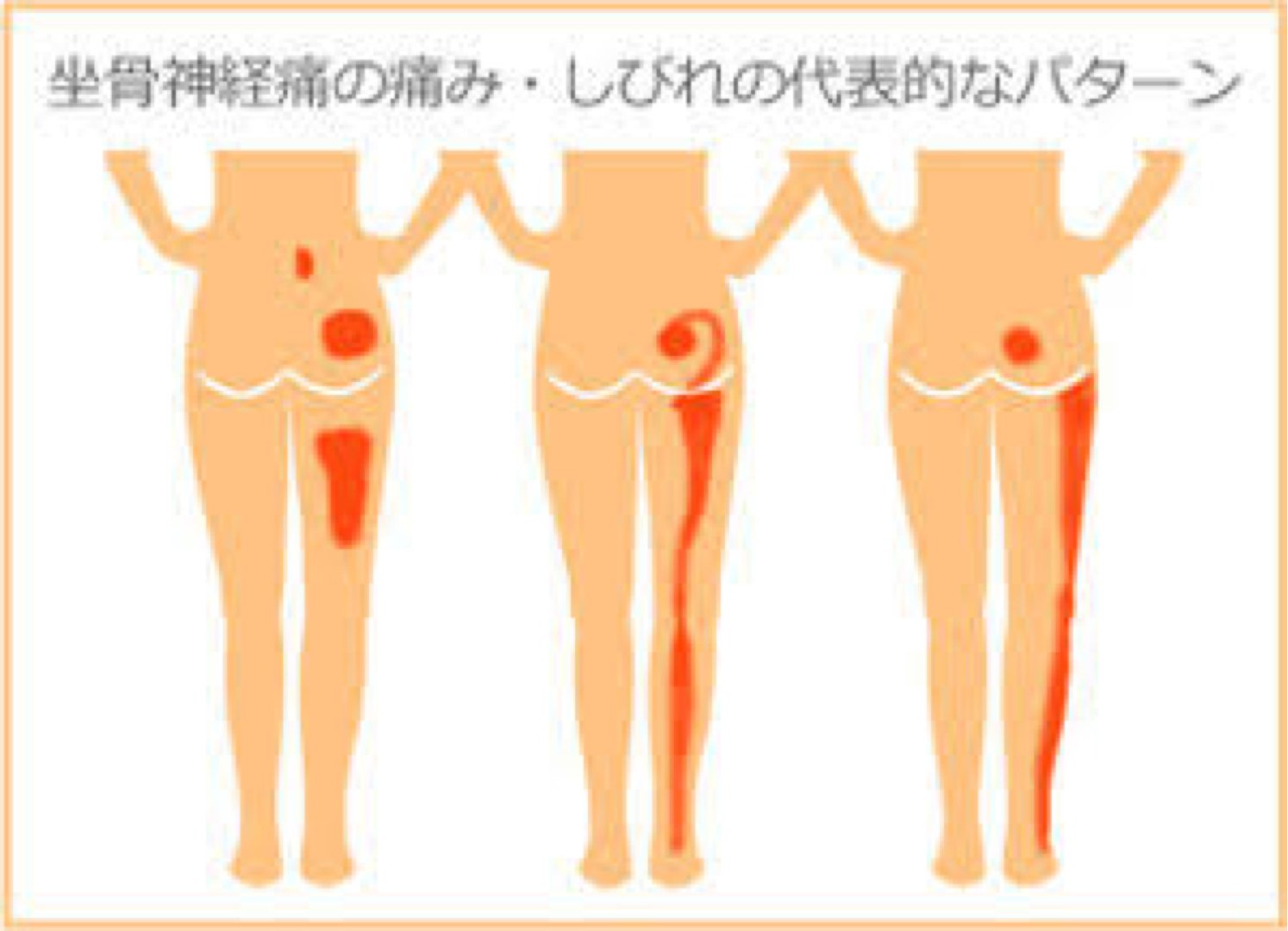 かまた鍼灸整骨院