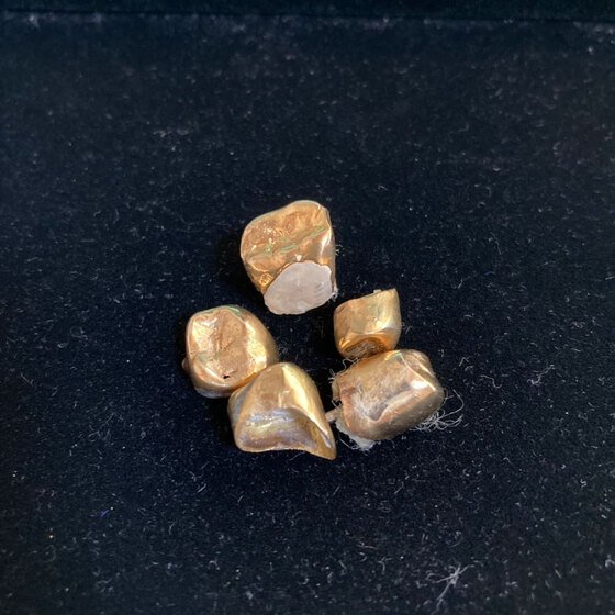 金歯買取