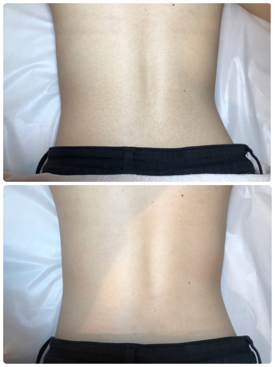 glamorous Brazilian Wax