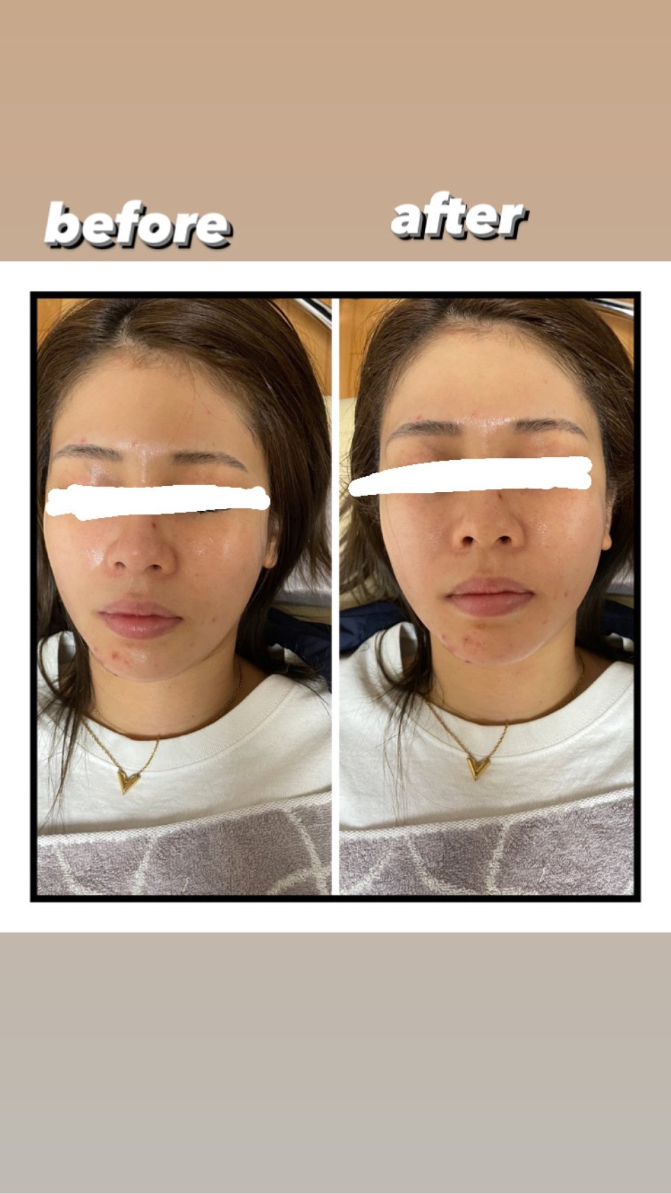 もぐさ鍼灸指圧院