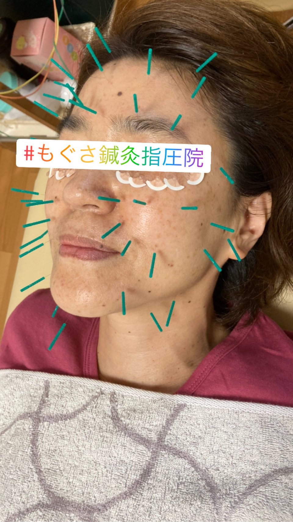もぐさ鍼灸指圧院