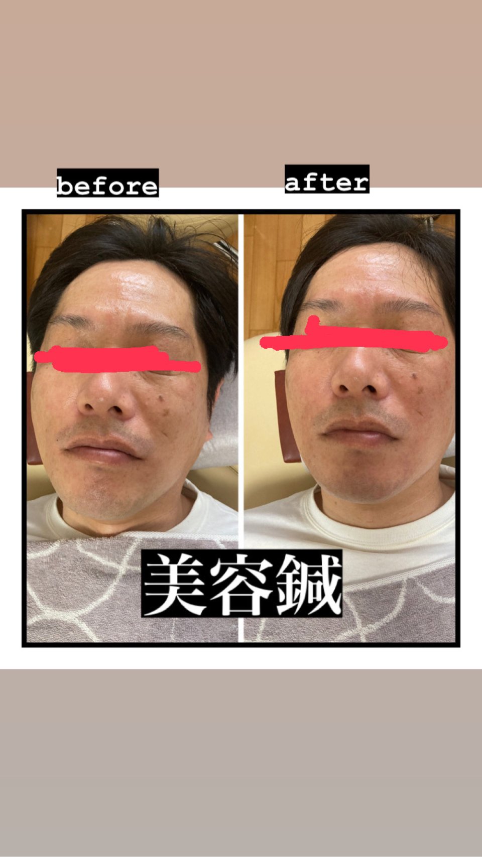 もぐさ鍼灸指圧院