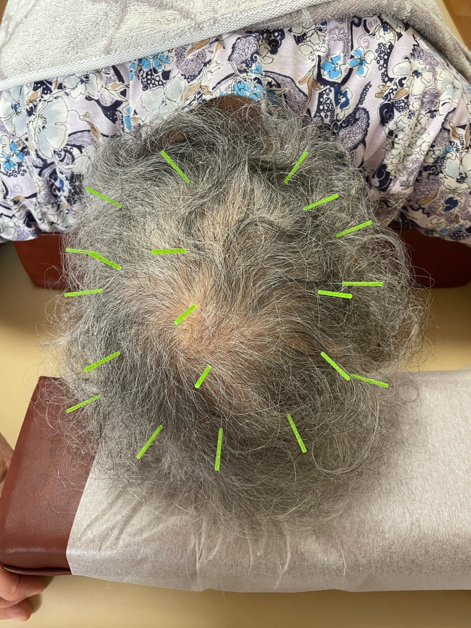 もぐさ鍼灸指圧院